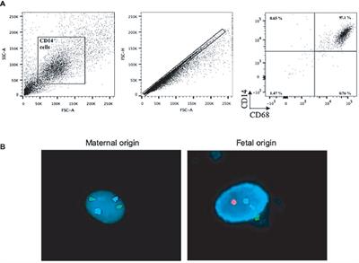 Full-Term Human Placental Macrophages Eliminate Coxiella burnetii Through an IFN-γ Autocrine Loop